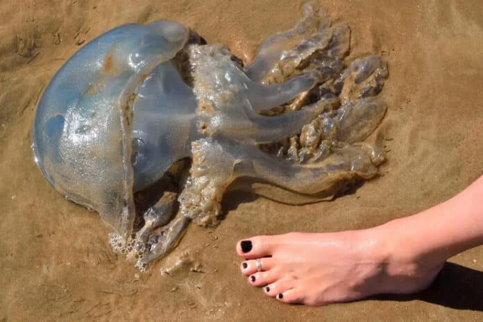 Jellyfish-Stings-Treatment