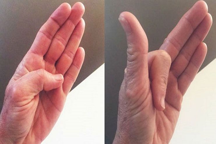 Finger Bends