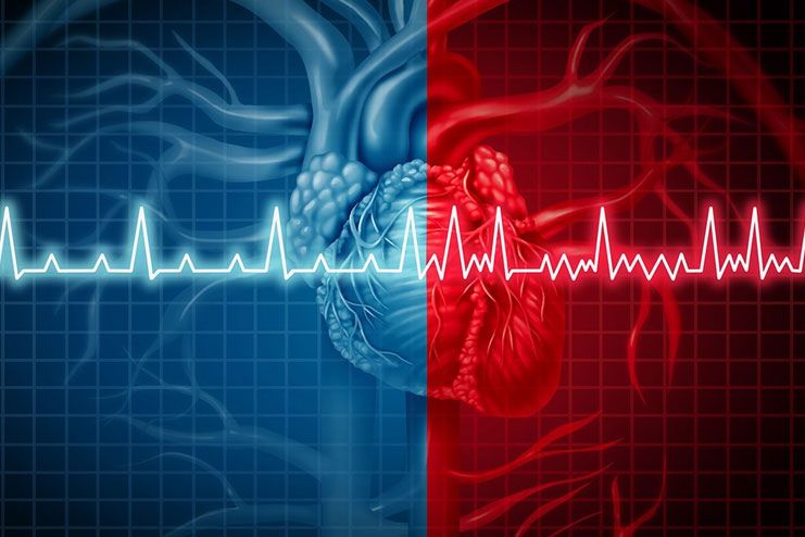 What is Heart Arrhythmia