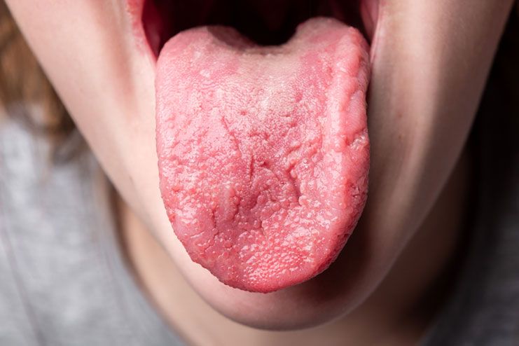 What causes taste buds to suddenly change suddenly