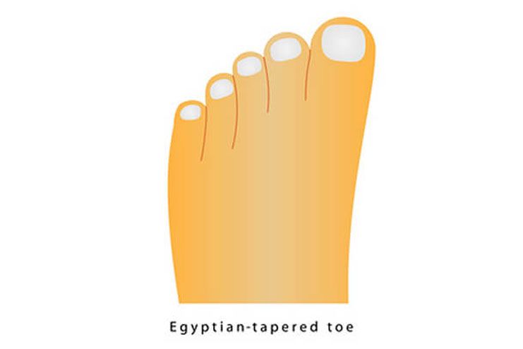 When you have the Egyptian toe