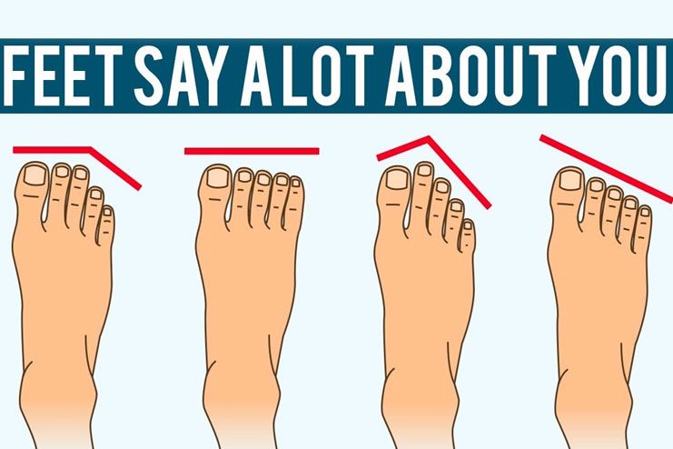 check what kind of foot shape you have